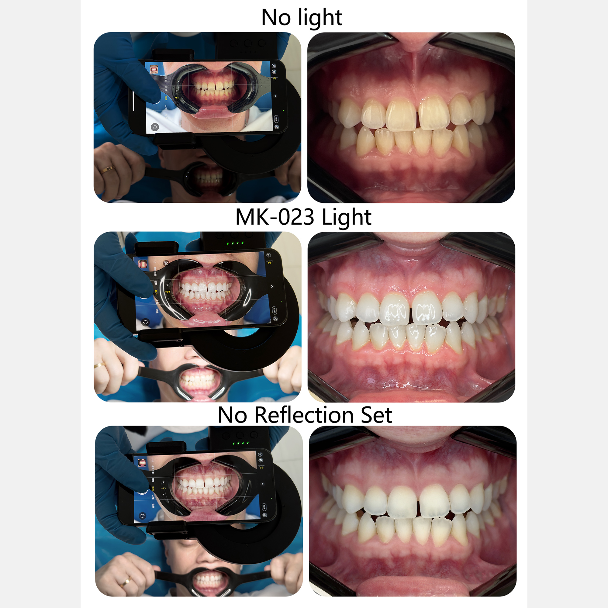 HERA MK-23 Intraoral Dental Ph - đánh giá và giá Photography Lighting Flash