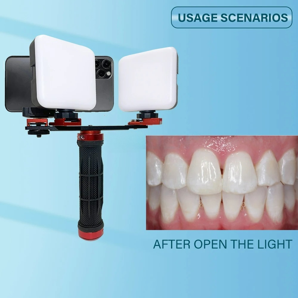 Dental Photography Light Phone - đánh giá và giá Photography Lighting Accessories