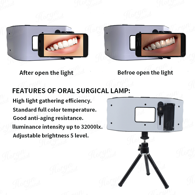Dental Flash Light Photography - đánh giá và giá Photography Lighting Flash
